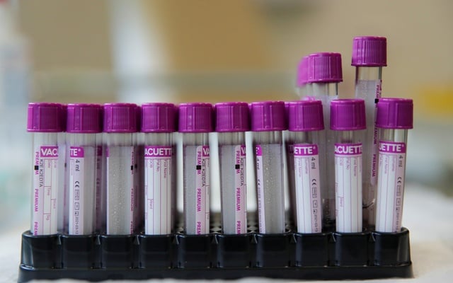 ইঁদুরের উপর ‘সফল’ করোনা ভাইরাসের টিকা!