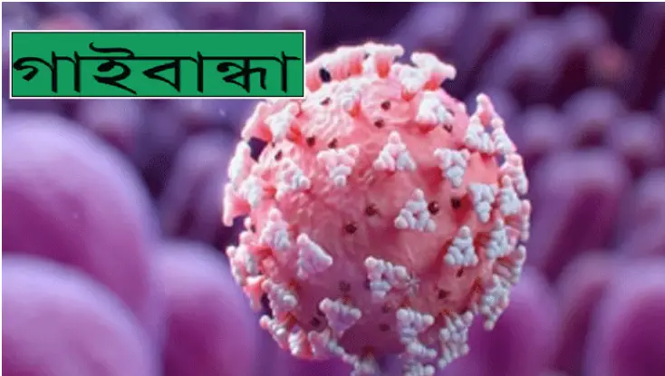 গাইবান্ধায় করোনায় মহিলা পুলিশসহ নতুন করে ৫ জন আক্রান্ত গাইবান্ধায় করোনায় মহিলা পুলিশসহ নতুন করে ৫ জন আক্রান্ত