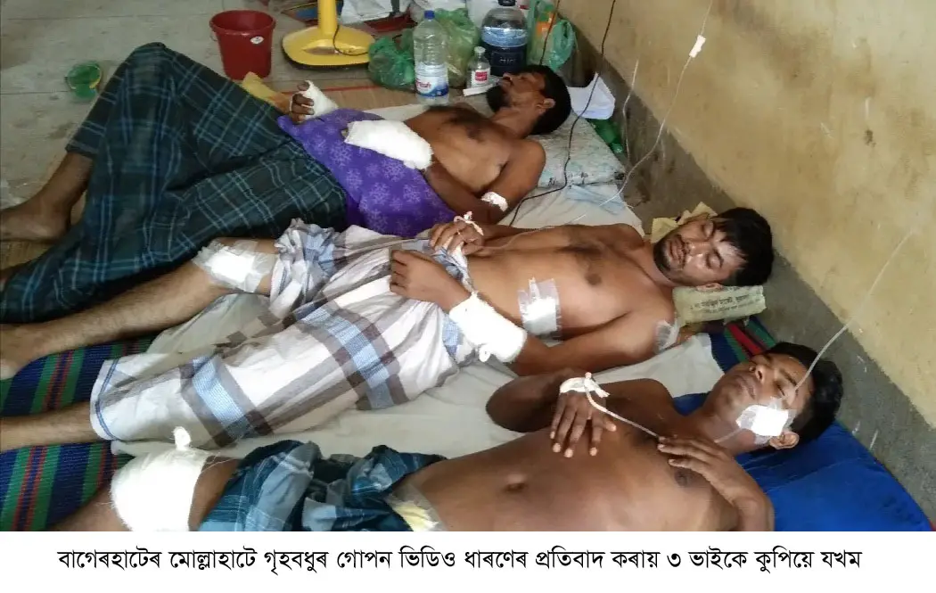 মোল্লাহাটে গৃহবধুর গোপন ভিডিও ধারণের প্রতিবাদ করায় ৩ ভাইকে কুপিয়ে যখম মোল্লাহাটে গৃহবধুর গোপন ভিডিও ধারণের প্রতিবাদ করায় ৩ ভাইকে কুপিয়ে যখম