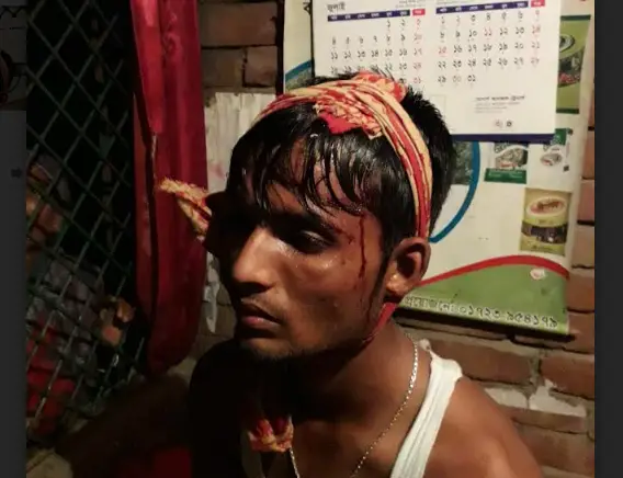 দৌলতপুরে দু’পক্ষের সংঘর্ষে আহত ৮, আটক ১ দৌলতপুরে দু’পক্ষের সংঘর্ষে আহত ৮, আটক ১