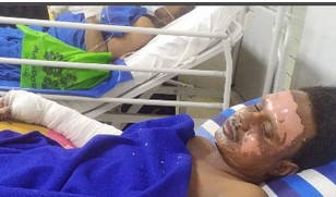 রাজধানীর পান্থপথে বিস্ফোরণ, তিতাসের ৩ কর্মীসহ দগ্ধ ৪ রাজধানীর পান্থপথে বিস্ফোরণ, তিতাসের ৩ কর্মীসহ দগ্ধ ৪