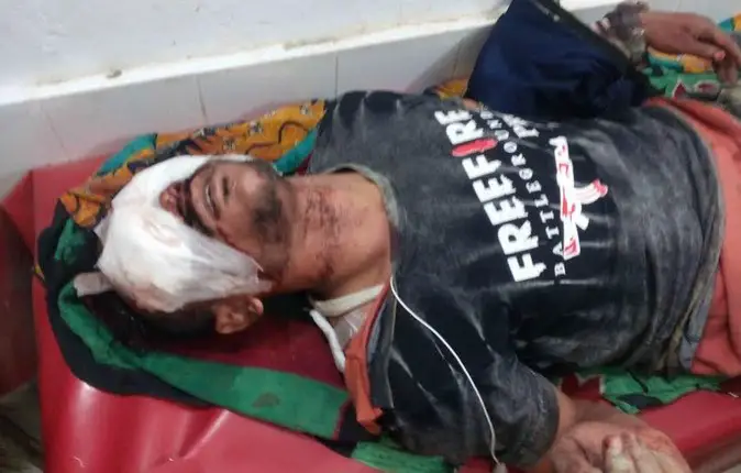 শরণখোলায় যুবকের পা ভেঙ্গে দুই চোখ নষ্ট করে দিয়েছে ক্ষিপ্তরা শরণখোলায় যুবকের পা ভেঙ্গে দুই চোখ নষ্ট করে দিয়েছে ক্ষিপ্তরা
