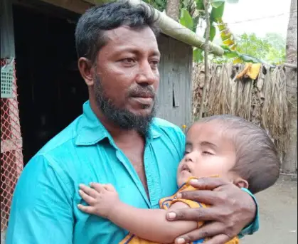 মোল্লাহাটে অর্থের অভাবে বিনা চিকিৎসায় ভূগছে শিশু আরাফাত মোল্লাহাটে অর্থের অভাবে বিনা চিকিৎসায় ভূগছে শিশু আরাফাত