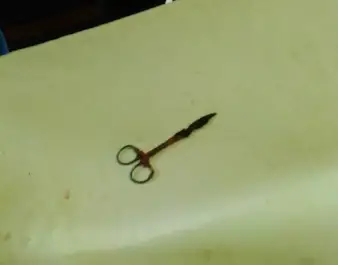 ২০ বছর পর চুয়াডাঙ্গার বাচেনার পেট থেকে অপসারণ করা হল কাঁচি ২০ বছর পর চুয়াডাঙ্গার বাচেনার পেট থেকে অপসারণ করা হল কাঁচি