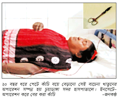 অবশেষে সেই নারীর পেট থেকে বের করা হলো কাঁচি অবশেষে সেই নারীর পেট থেকে বের করা হলো কাঁচি
