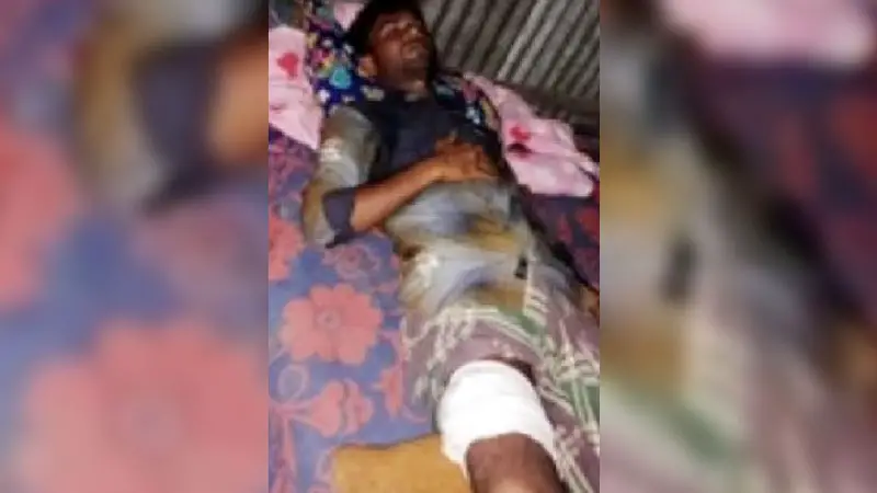 কুমিরের চোখে আঙুল দিয়ে বেঁচে ফিরলেন যুবক কুমিরের চোখে আঙুল দিয়ে বেঁচে ফিরলেন যুবক