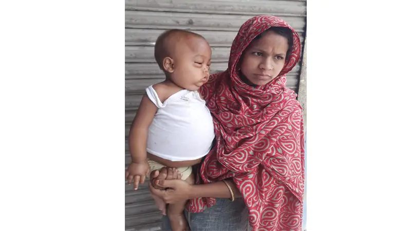 শিশু রাহুলকে বাঁচাতে সাহায্য চান তার পরিবার শিশু রাহুলকে বাঁচাতে সাহায্য চান তার পরিবার