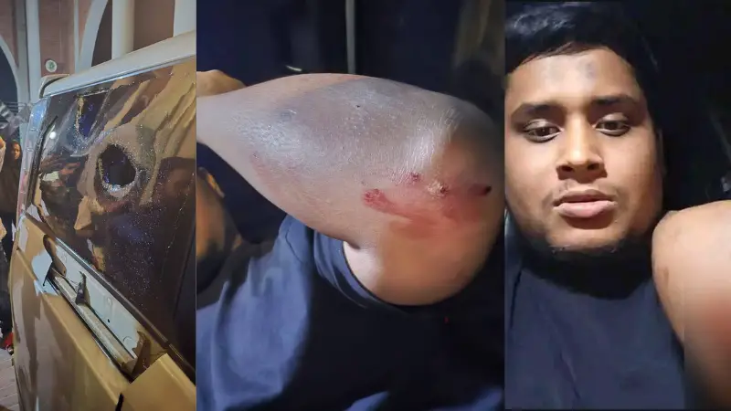 গাজীপুরে সন্ত্রাসী হামলায় আহত হাসনাত আব্দুল্লাহ! গাজীপুরে সন্ত্রাসী হামলায় আহত হাসনাত আব্দুল্লাহ!