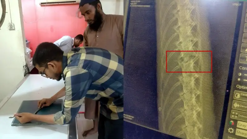 আহত সাপ চিকিৎসার প্রশংসনীয় উদ্যোগ নিলেন নির্বাহী ম্যাজিস্ট্রেট ইয়াসীন সাদেক
