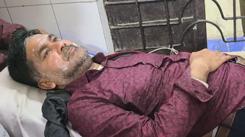 বিএনপির মিছিলে ককটেল বিস্ফোরণ, তিন নেতা আহত বিএনপির মিছিলে ককটেল বিস্ফোরণ, তিন নেতা আহত
