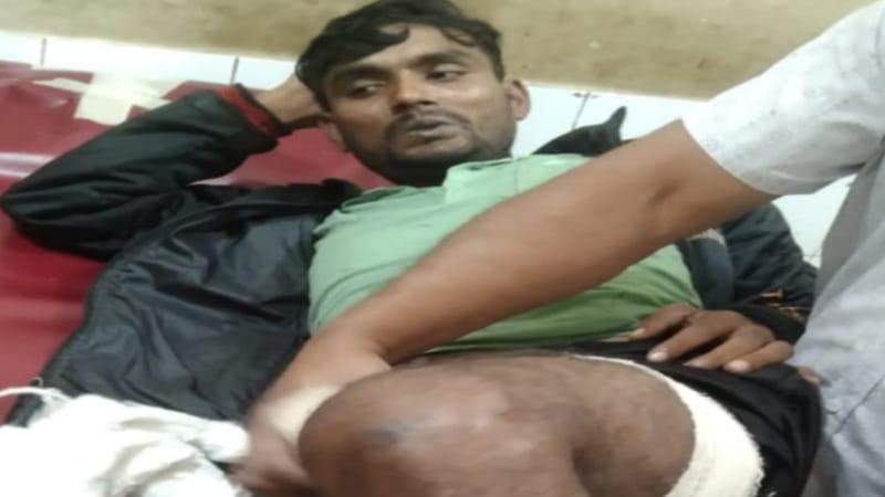 কুষ্টিয়ায় মাদক চোরাকারবারীদের হামলায় যুবক গুলিবিদ্ধ কুষ্টিয়ায় মাদক চোরাকারবারীদের হামলায় যুবক গুলিবিদ্ধ