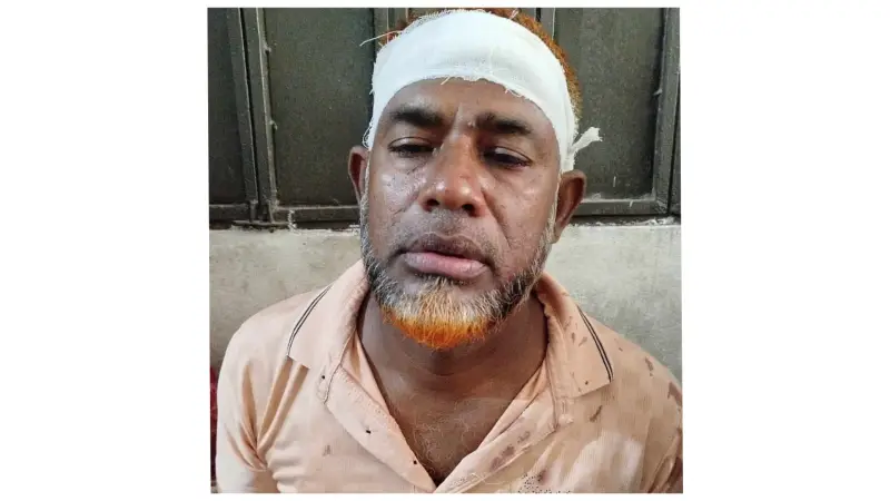 বরিশালে বিএনপি নেতাকে কুপিয়ে জখম বরিশালে বিএনপি নেতাকে কুপিয়ে জখম