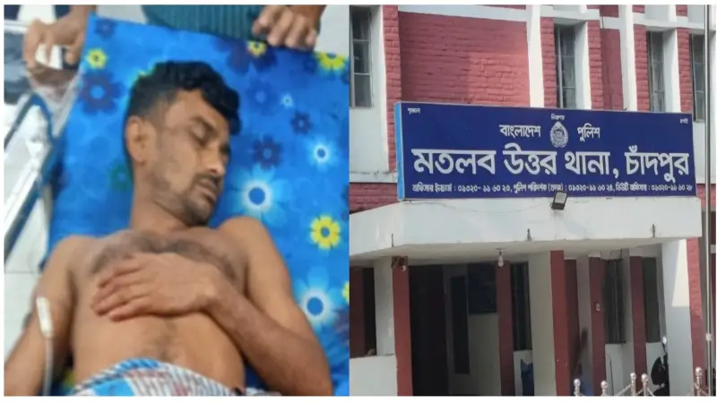 স্বামীর গোপনাঙ্গ কেটে পালালেন দ্বিতীয় স্ত্রী, হাসপাতালে নিলেন তৃতীয় স্ত্রী স্বামীর গোপনাঙ্গ কেটে পালালেন দ্বিতীয় স্ত্রী, হাসপাতালে নিলেন তৃতীয় স্ত্রী