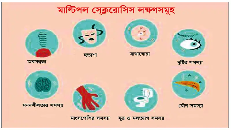 মাল্টিপল স্ক্লেরোসিস কি ও চিকিৎসা মাল্টিপল স্ক্লেরোসিস কি ও চিকিৎসা