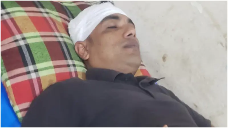ইমাম নিয়ে বিরোধ: যুবদল কর্মী রক্তাক্ত জখম ইমাম নিয়ে বিরোধ: যুবদল কর্মী রক্তাক্ত জখম