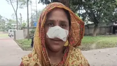 স্ত্রীর নাক সুন্দর, ঘুমন্ত অবস্থায় কামড়ে নিলেন স্বামী!