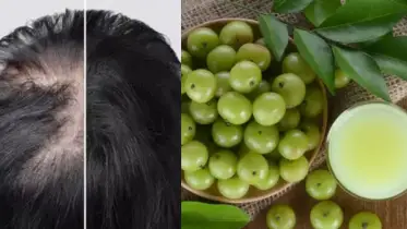 যেভাবে আমলকির সাহায্যে টাক মাথায় চুল গজাবে