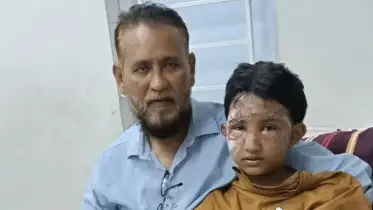 কক্সবাজারের মেয়ে আলবীরা সুস্থ হয়ে উঠছে, সবার প্রতি বাবার কৃতজ্ঞতা