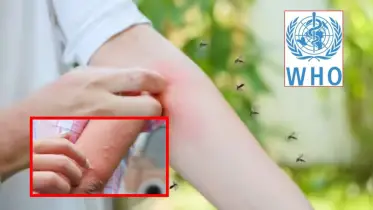 ডেঙ্গু থেকে জিকা: মশাবাহিত রোগ মোকাবেলায় WHO-এর ৬ দফা নতুন গাইডলাইন, যা সবাইকে জানা জরুরি