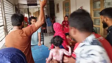 চিকিৎসাধীন অবস্থায় মারা গেছে রামনগরে আগুনে দগ্ধ শিশু আরিসা