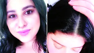 অকালে চুল পাকার কারণ