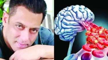 মস্তিষ্কের অ্যানিউরিজম অবহেলা নয়