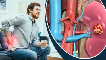 কিডনি ভালো রাখতে মেনে চলুন এই ৭টি অভ্যাস