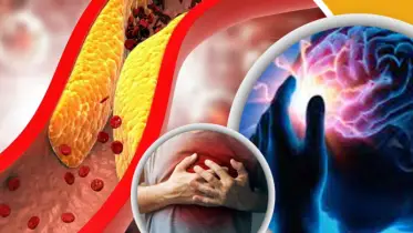 শরীর থেকে খারাপ কোলেস্টেরল ও হৃদ্‌রোগের ঝুঁকি কমায় যে ফল