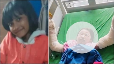 নিজের বুদ্ধিমত্তায় শঙ্কামুক্ত মাইলস্টোন ট্র্যাজেডিতে আহত কক্সবাজারের ছোট্ট আলবীরা