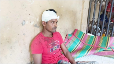 ধর্ষণ মামলায় সাজা হওয়ায় বাদীকে কুপিয়ে জখম