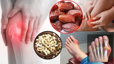 কাজু থেকে খেজুর: ইউরিক অ্যাসিড কমাতে সহায়তা করে যেসব শুকনো ফল