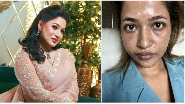 জীবন আমাকে ক্ষমতার সুযোগ দিয়েছিল কিন্তু আমি বেছে নিয়েছিলাম সত্যিকারের স্বাধীনতা: বাঁধন