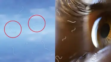 চোখের সামনে এমন দাগ কি আপনিও দেখতে পান?