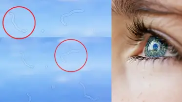 চোখের সামনে ভেসে বেড়ানো এমন দাগ আপনিও দেখতে পান? সতর্ক হোন!