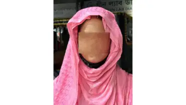 বাউফলে যৌতুকের দাবিতে স্ত্রীকে পৈশাচিক নির্যাতন