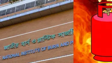 গ্যাস লিকেজ থেকে বিস্ফোরণে শিশুসহ একই পরিবারের তিনজন দগ্ধ
