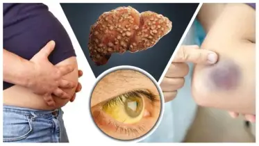লিভার সুস্থ রাখতে আজই যে ৩টি কাজ বন্ধ করতে হবে