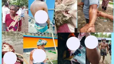 নাঙ্গলকোটে দুই গোষ্ঠীর মধ্যে সংঘর্ষ, গুলিবিদ্ধ ১৫, আহত ১০