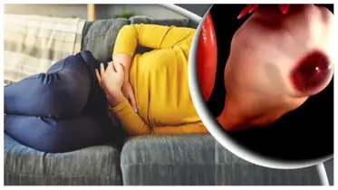 ফাইব্রইয়েড ও সিস্টের পার্থক্য কী জানেন?
