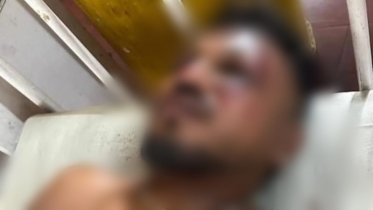 বিমানের ধ্বংসে ২০০ প্রাণহানি, একাই বেঁচে ফিরলেন বিশ্বাস কুমার!