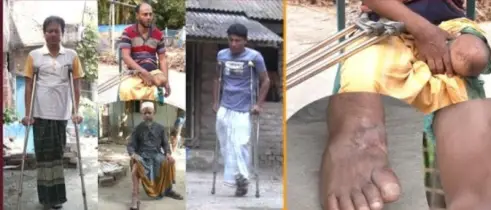 স্প্রে দিয়ে পা অবশ করে বন্দুকের নল ঠেকিয়ে গুলি করে চলতো পুলিশি বীভৎসতা