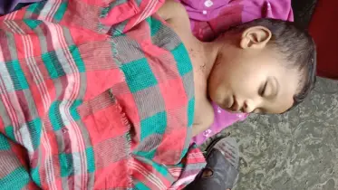 ঝিনাইদহে সবজি কাটা বটি ঘাড়ের উপর পড়ে শিশুর মর্মান্তিক মৃত্যু