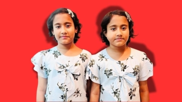 আগুনে পোড়া যমজ মেয়েদের আর্তনাদে কাঁপছে হাসপাতাল, মা-বাবার কান্নায় ভারী আকাশ