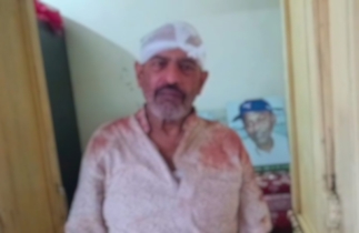 পাবনায় প্রকাশ্য দিবালোকে নিজ বাড়িতে প্রবীণ অধ্যাপককে কোপালো দুর্বৃত্তরা