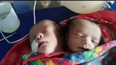 পঞ্চগড়ে দুই মাথাবিশিষ্ট শিশু ভূমিষ্ঠ: উৎসুক মানুষের ঢল