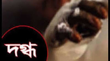 আফতাবনগরে গ্যাস লিকেজে আগুন; দগ্ধ ৪ বছরের শিশুর মৃত্যু, পরিবারে আরও ৪ জন আশঙ্কাজনক