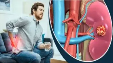 নষ্ট কিডনি কি ভালো হয়?
