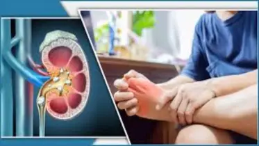 ইউরিক অ্যাসিডের ব্যথা কমানোর ঘরোয়া ৫ কার্যকর উপায়   