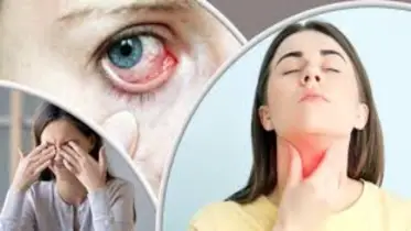 চোখ দেখে বুঝে নিন, থাইরয়েডের সমস্যা রয়েছে কিনা