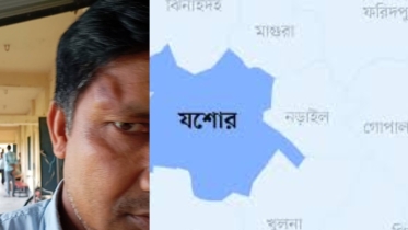 ইউএনওর কাছে অভিযোগ করায় শিক্ষক নেতার হাতে সহকর্মী মারধরের শিকার, মামলা দায়ের